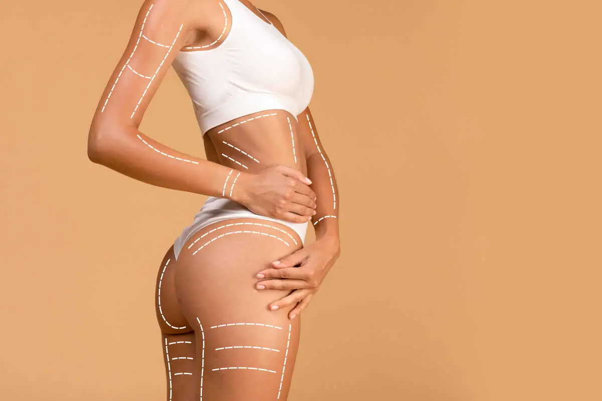 Cynosure Sculpsure Treatment by Urban Medspa & Weight Loss Center
