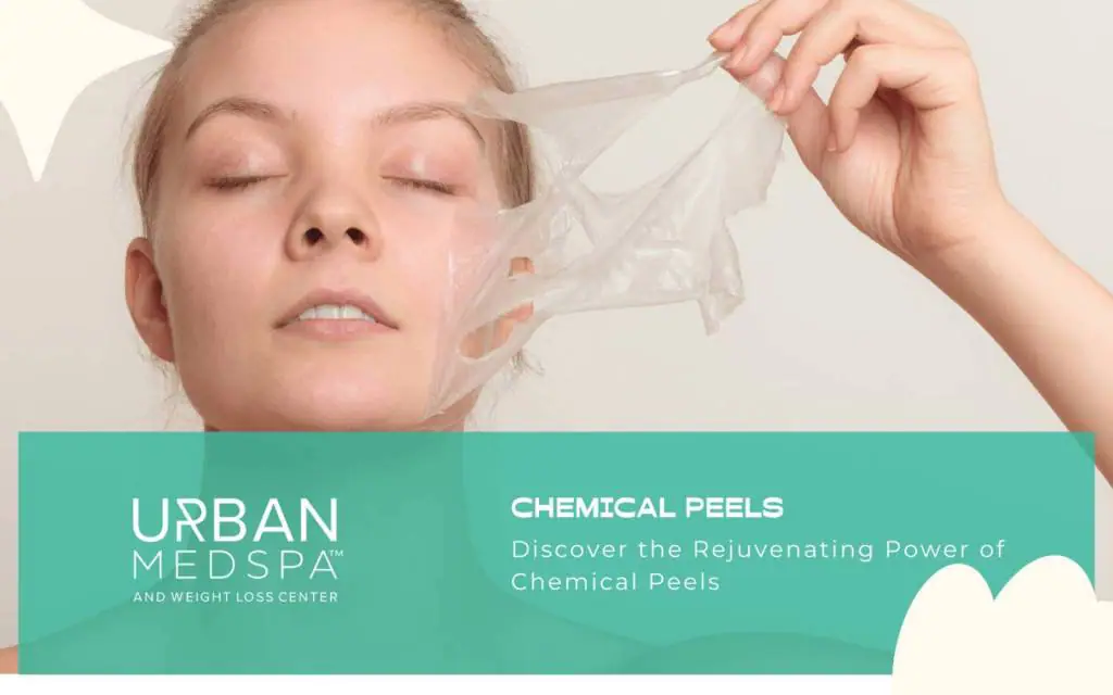 Discover the Rejuvenating Power of Chemical Peels