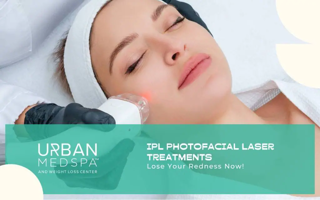IPL Photofacial Laser Treatments Lose Your Redness Now