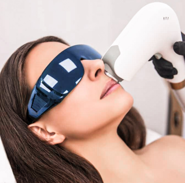 IPL Photofacial Laser Treatments