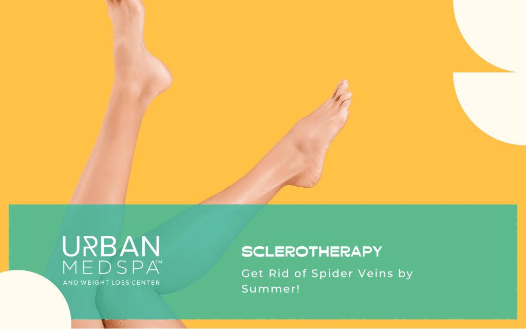 Get Rid Of Spider Veins By Summer!