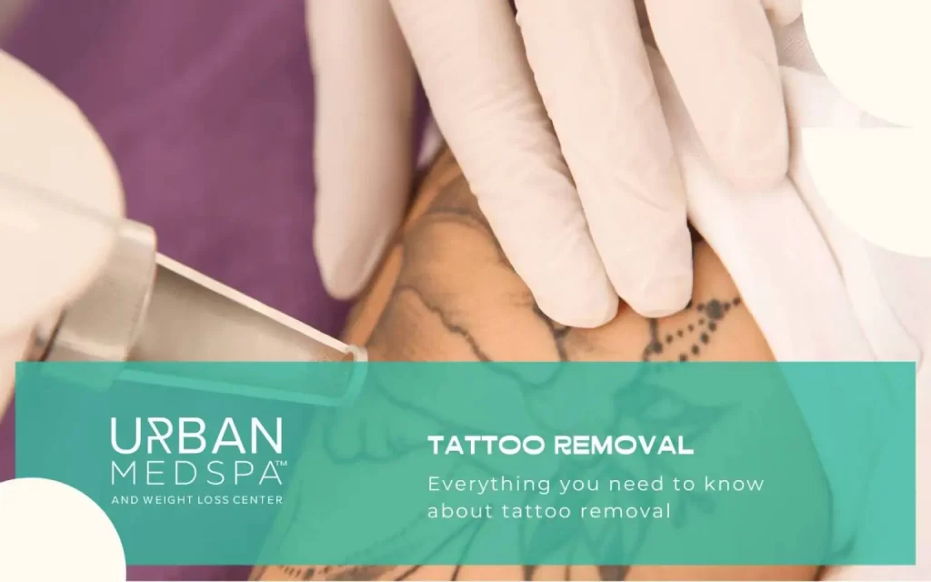 urban medspa weight loss center how many sessions to remove a tattoo in charlottle nc